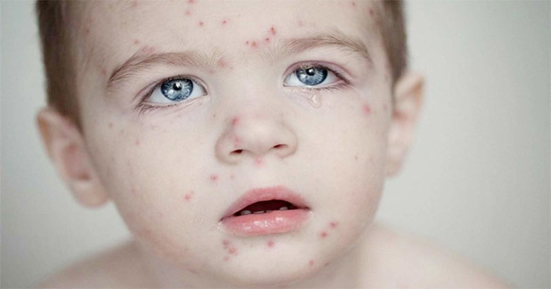 প্রতীকী ছবি