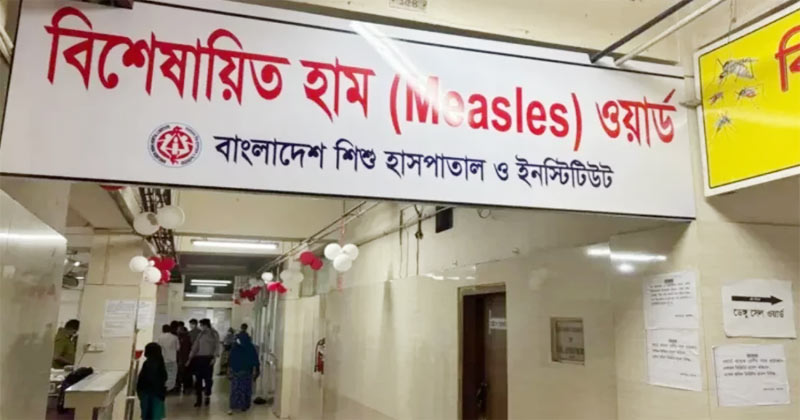 হাম উপসর্গে আরও ৫ শিশুর মৃত্যু